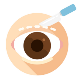 [쌍꺼풀수술] 이백안과 삼백안! 그것이 알고 싶다~! 관련 이미지 6