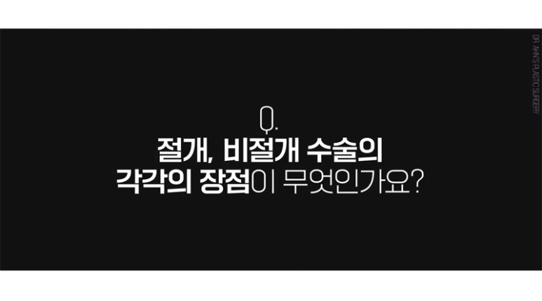 눈매교정을 하기 전 절개이냐? 비절개이냐? 선택은! 관련 이미지 9