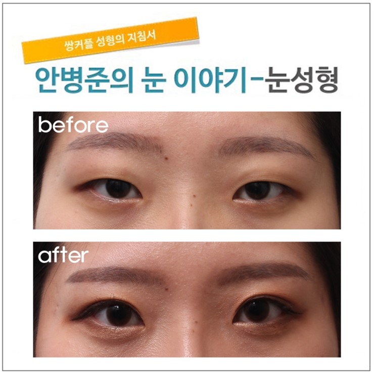 전형적인 한국여성의 눈 관련 이미지 1