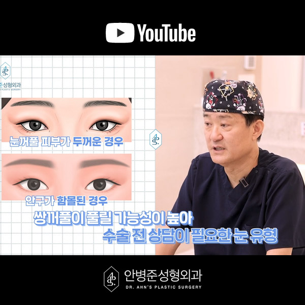 [방배역성형외과] 쌍꺼풀 수술 후 부작용과 대처 방법 관련 이미지 5