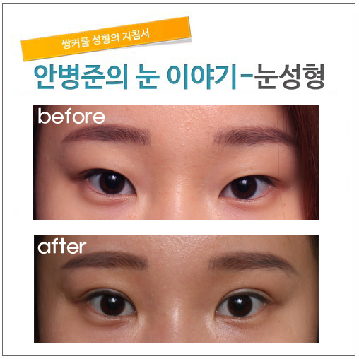 눈꼬리가 올라간 눈 관련 이미지 1