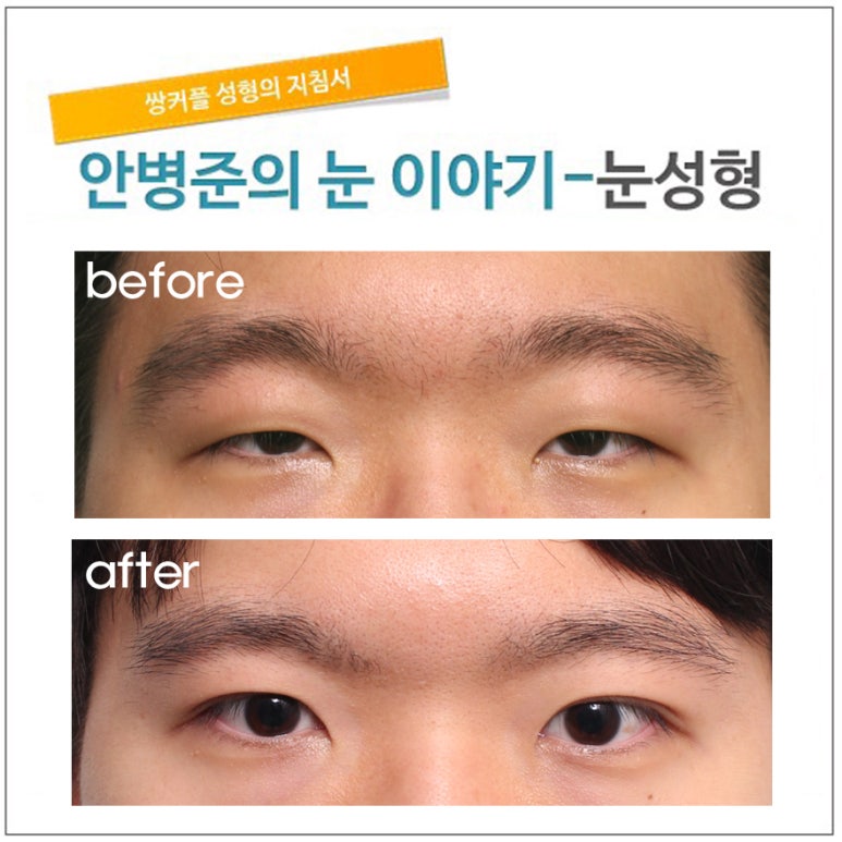 눈뜨기가 무겁고 힘들때. 관련 이미지 1