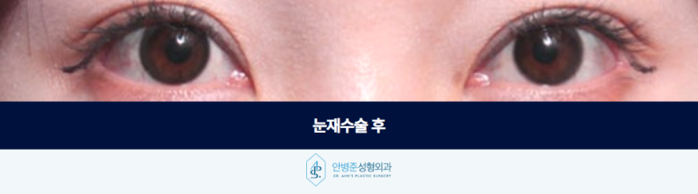 If you want the desired results from double eyelid revision surgery, you have to start over with the design image 3