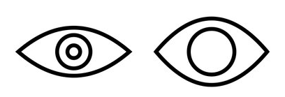 수술 후 짝짝이 눈 교정, 오른쪽 눈 라인 맞추기 사례! 관련 이미지 2