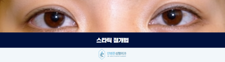 쌍꺼풀 라인 고정 자연스러움을 이끌어내는 기준 관련 이미지 6