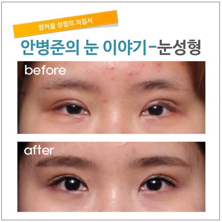 첫수술의 중요성 [재건]-완성편. 관련 이미지 3