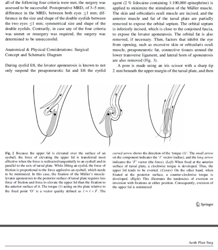 시크릿성형외과 안병준 원장의 눈매교정 유럽학회발표 관련 이미지 4