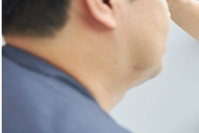 쌍꺼풀 수술 눈매교정술 남성 눈에서 더 신경 써야 하는 부분 관련 이미지 12
