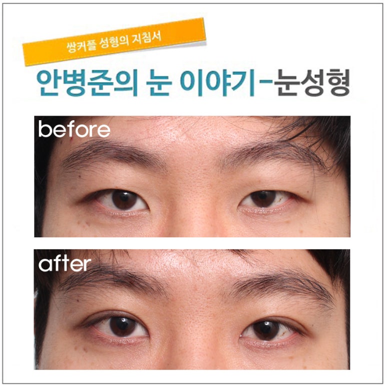 흔히 보는 짝눈 관련 이미지 1