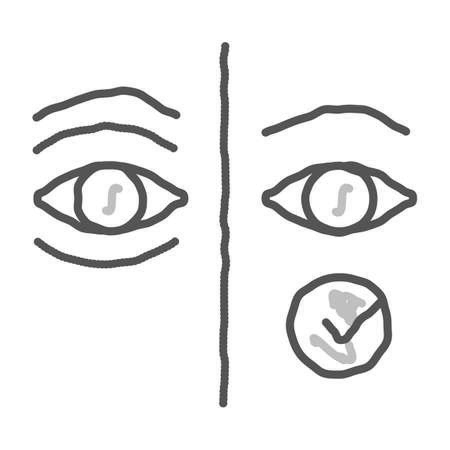 처진 눈, 그늘진 눈 밑, 노화의 흔적... 상안검 / 하안검 관련 이미지 3