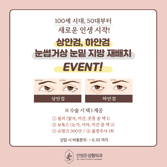 [이벤트] 상안검,하안검,눈썹거상 눈밑 지방재배치 관련 이미지 1