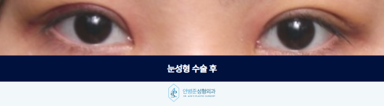 눈성형 수술 전문의와 함께 소통하면서 만들어지는 결과입니다 관련 이미지 3