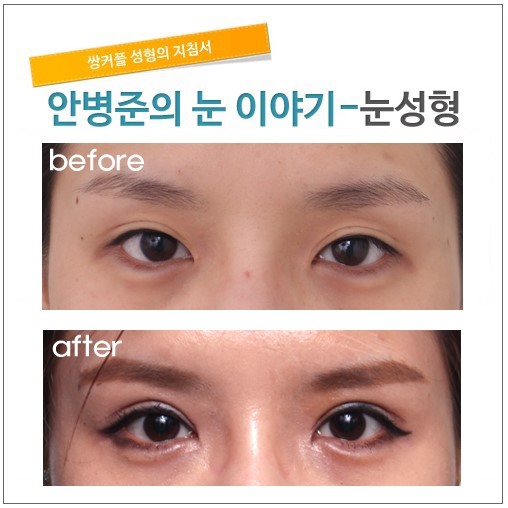 풀어진 라인 다시 잡기. 관련 이미지 1