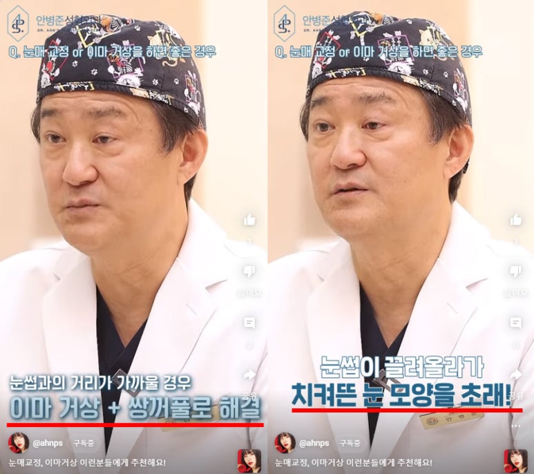 눈꺼풀 처짐의 포인트 - 안구함몰과 눈쌉과의 거리 관련 이미지 2