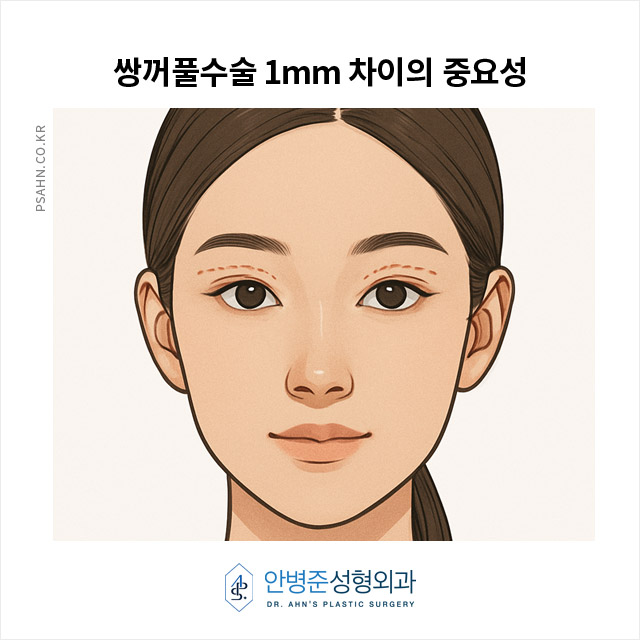 [안병준성형외과] 쌍꺼풀수술, 1mm 차이가 얼굴 조화를 바꾼다! 관련 이미지 1