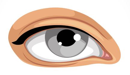 [남자쌍꺼풀] 남성 눈매 교정 - 안검하수와 처진 눈꺼풀 수술사례 관련 이미지 1