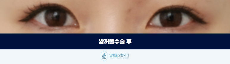 쌍꺼풀수술병원 선택 기본부터 충실한지 살펴보세요 관련 이미지 3