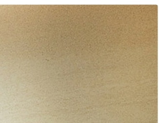 쌍꺼풀재수술 절개법을 이용하여 자연스러운 눈매를 찾다 관련 이미지 10