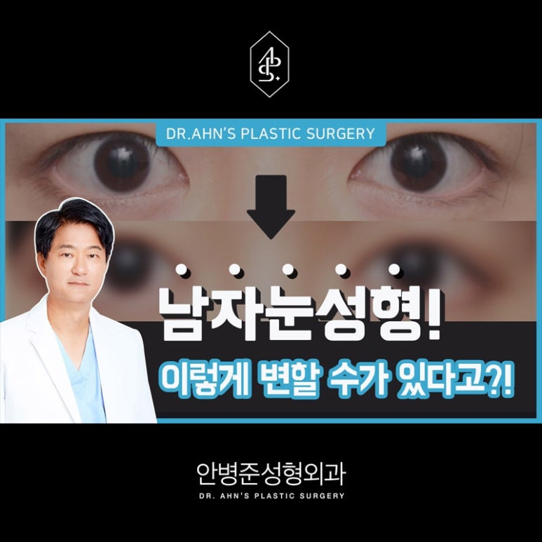 [남자성형외과] 남자 눈성형 쌍꺼풀수술 사례 모음 관련 이미지 1