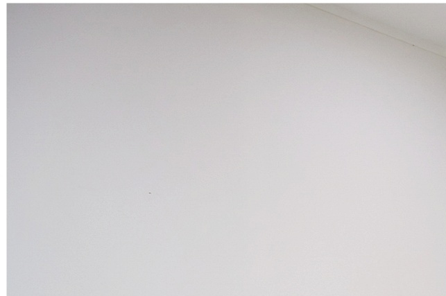 가성안검하수 알고보면 이 부분이 원인일 수 있습니다 관련 이미지 8