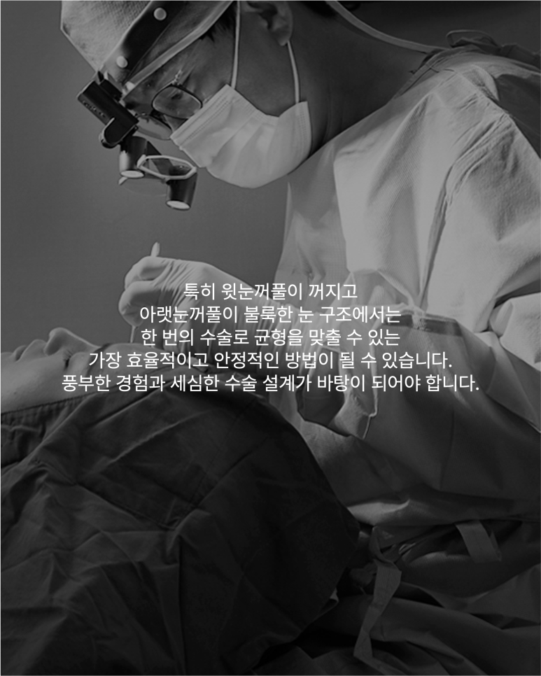 상하안검수술 필요한 순간 위아래 눈꺼풀을 함께 보는 이유 관련 이미지 6