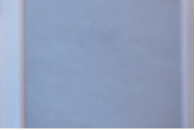 쌍꺼풀수술 자연스러운 눈을 만들기 위한 중요한 기준 관련 이미지 9