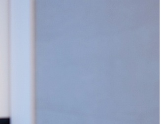 여자 눈매교정 안검하수 또렷하면서도 부드러운 인상을 찾다 관련 이미지 14