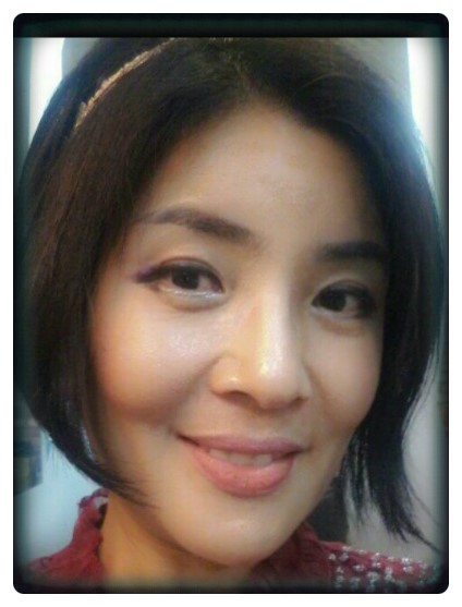 *상안검성형술*                      [안병준의 눈이야기] 관련 이미지 3