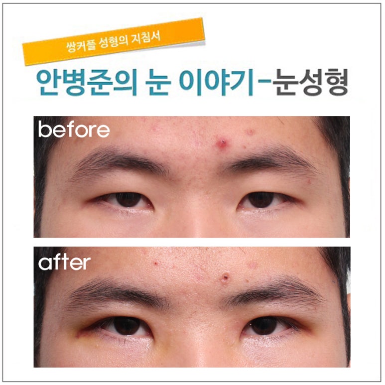 전형적인 동양 남자 눈 관련 이미지 1