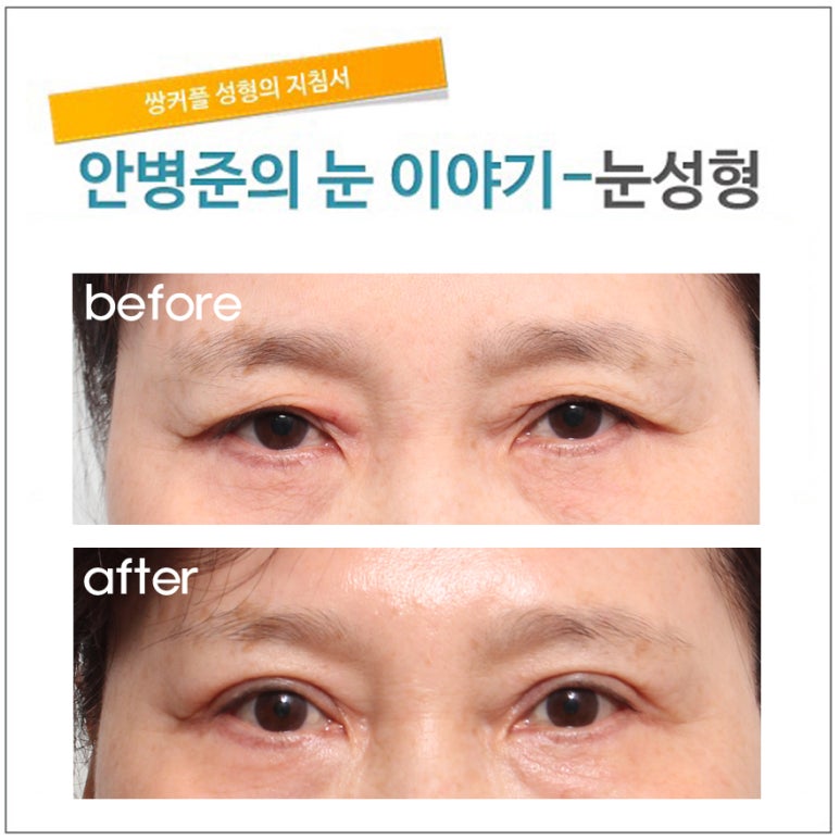 노화로 인한 주름 관련 이미지 1