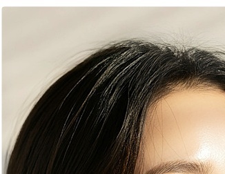 쥬베룩 효과 피부가 스스로 차오르는 변화를 원한다면 관련 이미지 8