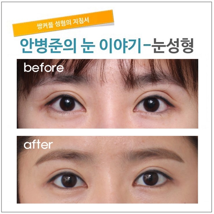 첫수술의 중요성 [재건]-완성편. 관련 이미지 1