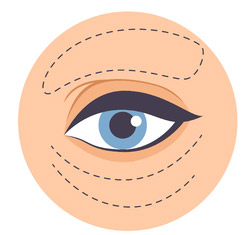 [강남역성형외과] 눈썹거상술? 눈썹밑절제술? 눈밑지방재배치? 관련 이미지 6