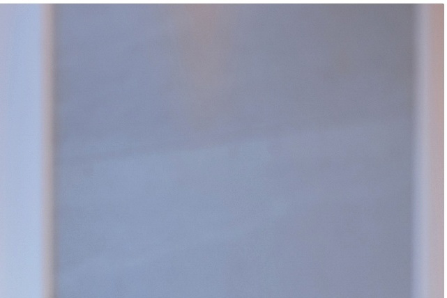 쌍꺼풀수술 자연스러운 눈을 만들기 위한 중요한 기준 관련 이미지 12