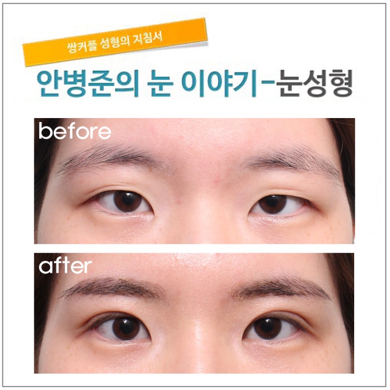 변화가 큰 전형적인 동양눈 관련 이미지 1