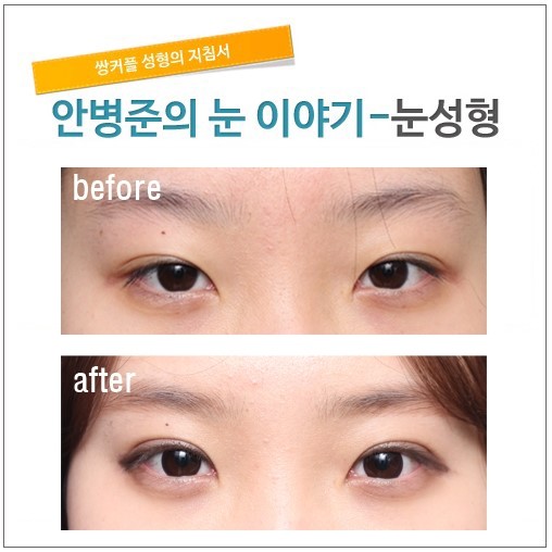 자꾸 풀리는 눈. 관련 이미지 1