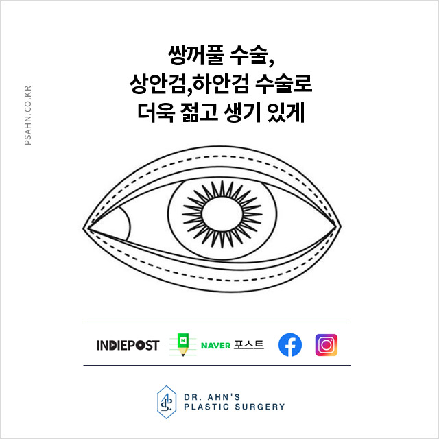 [기사] 상안검, 하안검 수술로 더욱 젋고 생기있게! 관련 이미지 1