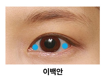 [쌍꺼풀수술] 이백안과 삼백안! 그것이 알고 싶다~! 관련 이미지 2