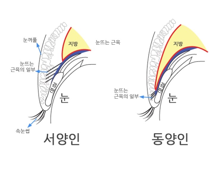 쌍꺼풀이란?_시크릿 성형외과 안병준의 쌍꺼풀 지침서 관련 이미지 1