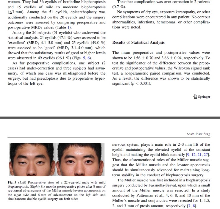 시크릿성형외과 안병준 원장의 눈매교정 유럽학회발표 관련 이미지 7