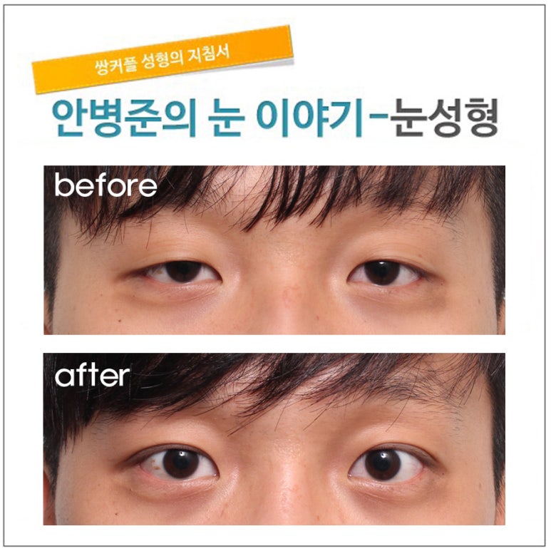 남자 짝눈 관련 이미지 1