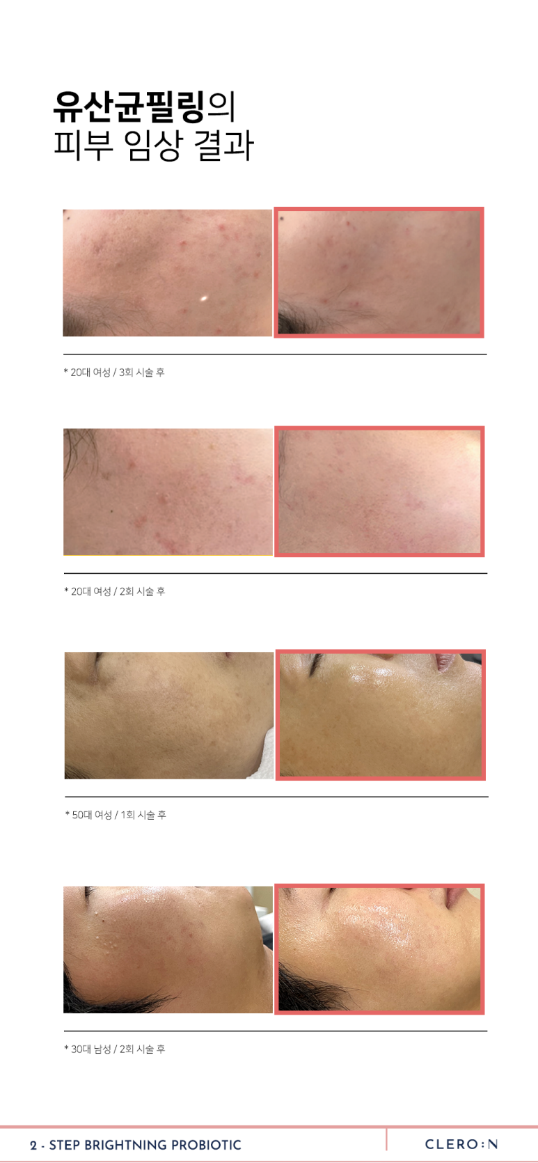 서울대입구 피부관리 유산균필 런칭특가 이벤트 관련 이미지 4