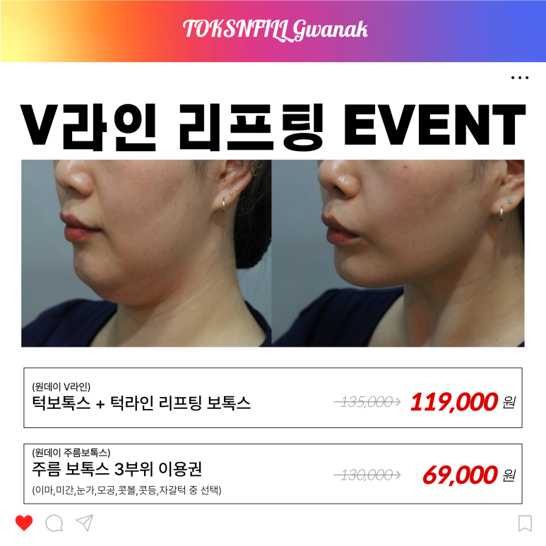 서울대입구역 피부과 2월 서울대점 단독 빅이벤트!! 관련 이미지 2