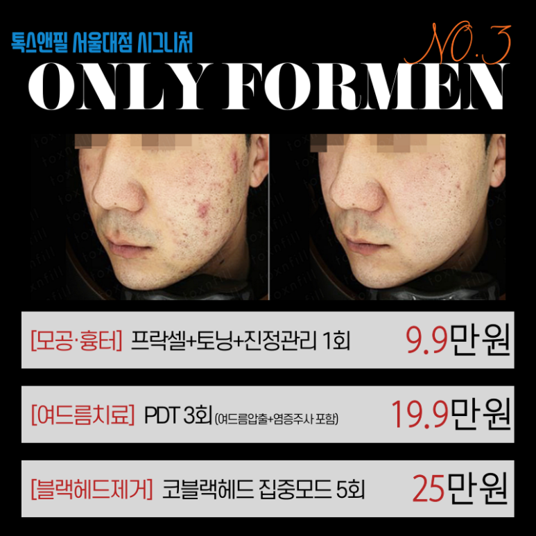 [톡스앤필 서울대점] 남자들을 위한 포맨이벤트 관련 이미지 5