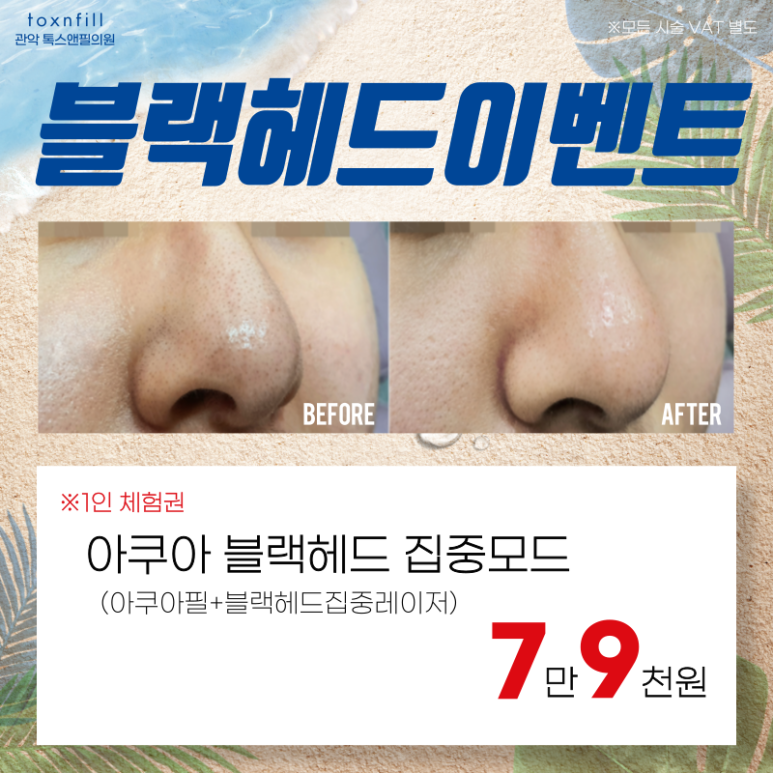 톡스앤필 서울대점만의 단 2주간 여름맞이 이벤트!! 관련 이미지 5