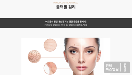서울대입구역 여드름 치료와 피부영양공급 천연필링(블랙필) 관련 이미지 4