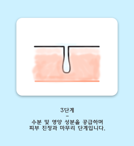 관악구 아쿠아필. 합리적 모공관리 관련 이미지 6