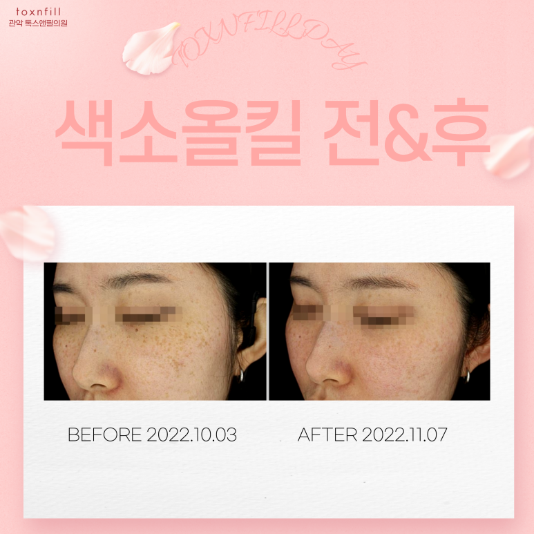 서울대입구 피부과 8월 대규모 이벤트 실시!! 관련 이미지 4