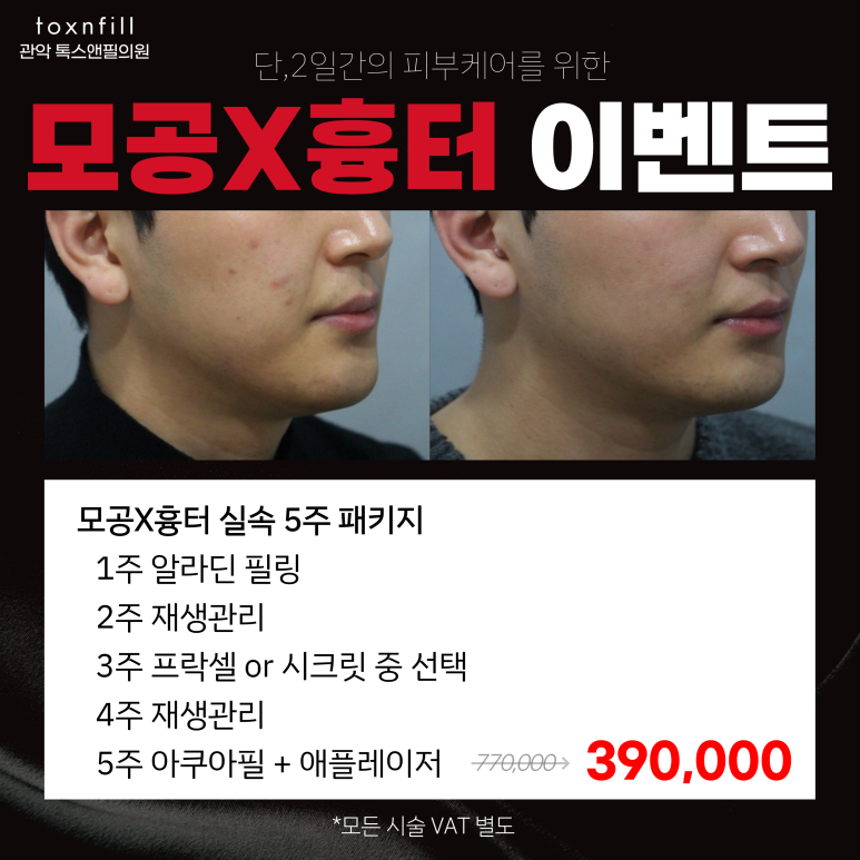 서울대입구역 피부과 단,2일간의 파격 혜택 이벤트 관련 이미지 2
