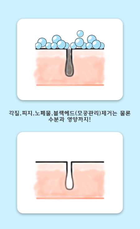 관악구 아쿠아필. 합리적 모공관리 관련 이미지 3